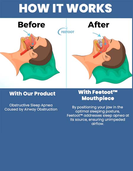 Feetoot Mouthpiece: Your Ultimate Solution for Oral Health and Comfort
