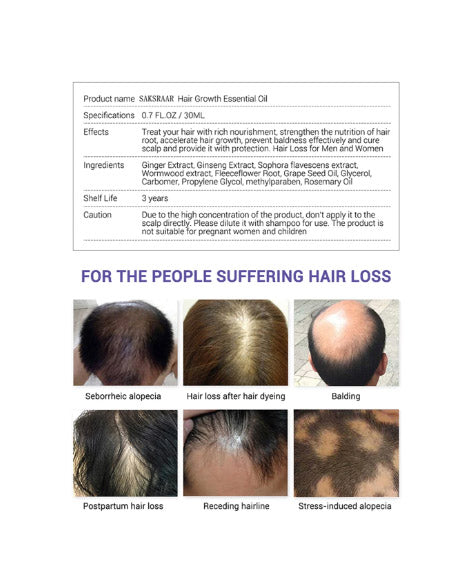 Load image into Gallery viewer, Revitalize Your Locks with our Hair Growth Essential Oil: Nourishing and Stimulating Formula for Healthy, Luxurious Hair Zydropshipping
